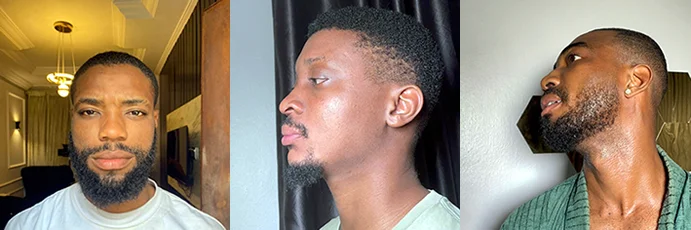 Nigerian men using Temique Turmeric Soap