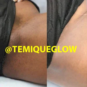 Before and After Temique — Blessing