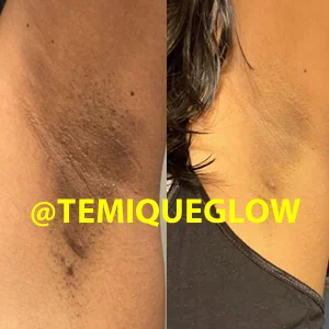 Before and After Temique — Fatima