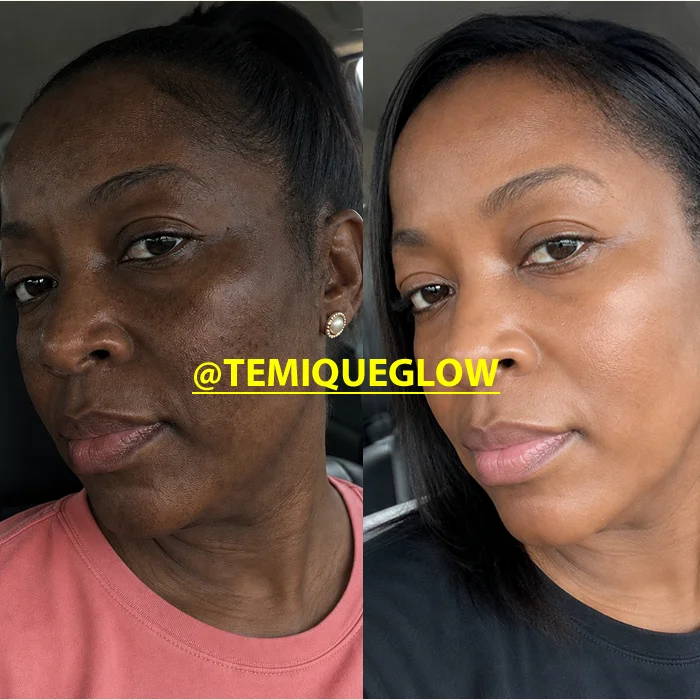 Before and After Temique — Jane
