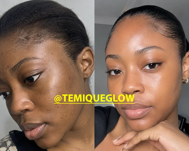 Before and After Temique — Nkiru