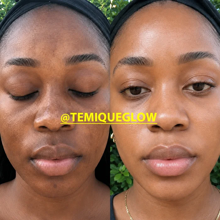 Before and After Temique — Queeneth